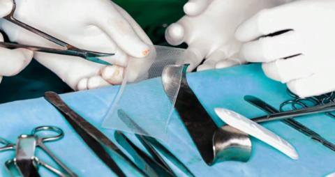 Mesh implants used "with no clinical evidence" (Screenshot) 