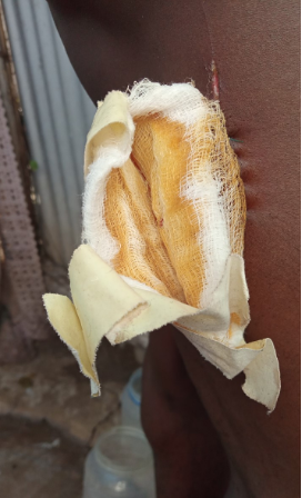 Examples of injuries
